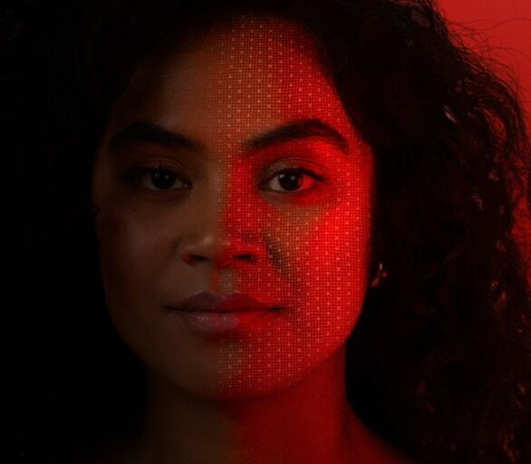 Redness